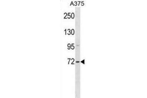 Western Blotting (WB) image for anti-Zinc Finger, SWIM-Type Containing 2 (ZSWIM2) antibody (ABIN3000270)