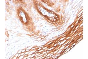 Formalin-fixed, paraffin-embedded human Skin stained with Cytokeratin 14 Mouse Monoclonal Antibody (KRT14/2375).