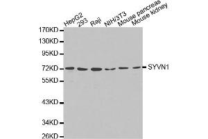 Western blot analysis of extracts of various cell lines, using SYVN1 antibody (ABIN5971424). (SYVN1 anticorps)