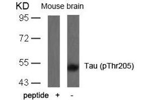 Western blot analysis of extracts from mouse brain tissue using Tau(Phospho-Thr205) Antibody and the same antibody preincubated with blocking peptide. (MAPT anticorps  (pThr205))