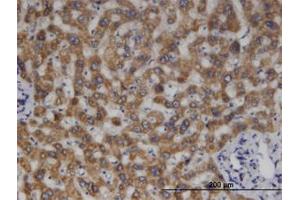 Image no. 1 for anti-Methylcrotonoyl-CoA Carboxylase 2 (Beta) (MCCC2) (AA 456-564) antibody (ABIN599583) (MCCC2 anticorps  (AA 456-564))
