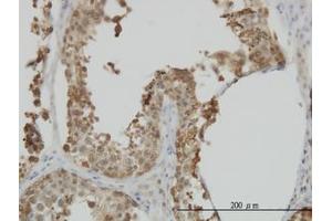 Image no. 3 for anti-Heat Shock 70kDa Protein 1-Like (HSPA1L) (AA 561-642) antibody (ABIN598752) (HSPA1L anticorps  (AA 561-642))