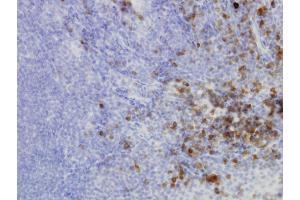 Immunoperoxidase of monoclonal antibody to HERPUD1 on formalin-fixed paraffin-embedded human tonsil.