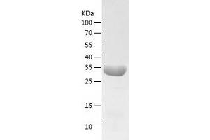 Western Blotting (WB) image for Ornithine Carbamoyltransferase (OTC) (AA 33-354) protein (His-IF2DI Tag) (ABIN7124271)