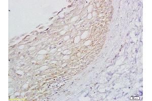 Formalin-fixed paraffin embedded rat ovary tissue labeled with Anti-ADRB1 Polyclonal Antibody, Unconjugated  at 1:200 followed by conjugation to the secondary antibody and DAB staining