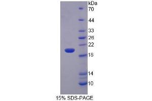 SDS-PAGE (SDS) image for Matrix Metallopeptidase 3 (Stromelysin 1, Progelatinase) (MMP3) (AA 278-450) protein (His tag) (ABIN1080277)