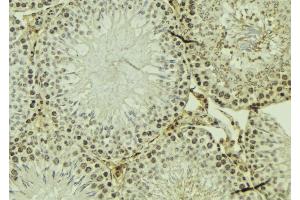 ABIN6274119 at 1/100 staining Mouse testis tissue by IHC-P. (TRIM3 anticorps  (Internal Region))