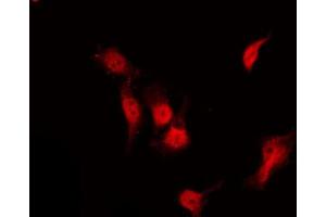 ABIN6267233 staining NIH-3T3 by IF/ICC. (HDAC3 anticorps  (pSer424))