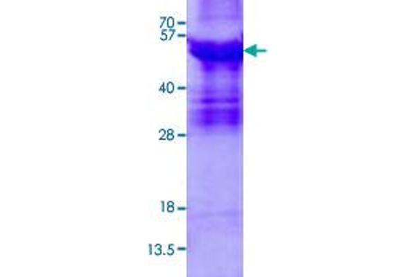 ABI3 Protein (AA 1-366) (His tag)