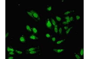 Immunofluorescent analysis of Hela cells using ABIN7155327 at dilution of 1:100 and Alexa Fluor 488-congugated AffiniPure Goat Anti-Rabbit IgG(H+L)