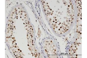Immunoperoxidase of monoclonal antibody to TTRAP on formalin-fixed paraffin-embedded human testis.