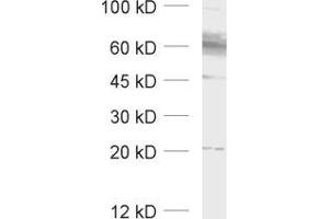Western Blotting (WB) image for anti-Solute Carrier Family 1 (Glial High Affinity Glutamate Transporter), Member 3 (SLC1A3) (AA 186-202), (Extracellular Domain) antibody (ABIN1742505)