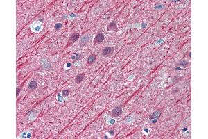 anti-Tubulin, beta 2A (TUBB2A) (AA 1-446) antibody