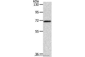 Western blot analysis of Mouse liver tissue, using SOX13 Polyclonal Antibody at dilution of 1:800 (SOX13 anticorps)