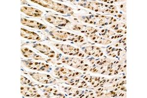 Immunohistochemistry of paraffin embedded rat stomach using Transketolase (ABIN7075978) at dilution of 1: 2200 (400x lens)