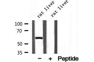 Western blot analysis of extracts of rat liver tissue, using D2HGDH antibody.