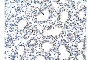 THOC1 antibody was used for immunohistochemistry at a concentration of 4-8 ug/ml to stain Alveolar cells (arrows) in Human Lung. (THOC1 anticorps  (C-Term))