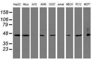 Image no. 3 for anti-serpin Peptidase Inhibitor, Clade B (Ovalbumin), Member 1 (SERPINB1) (AA 77-306) antibody (ABIN1491670)