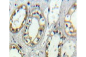 IHC-P analysis of Kidney tissue, with DAB staining. (ITGAD anticorps  (AA 886-1106))