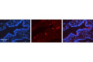 Rabbit Anti-SCGB1A1 Antibody   Formalin Fixed Paraffin Embedded Tissue: Human Lung Tissue Observed Staining: Cytoplasm, Plasma membrane Primary Antibody Concentration: 1:600 Other Working Concentrations: N/A Secondary Antibody: Donkey anti-Rabbit-Cy3 Secondary Antibody Concentration: 1:200 Magnification: 20X Exposure Time: 0. (SCGB1A1 anticorps  (Middle Region))