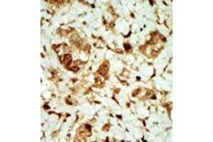 Image no. 2 for anti-Protein Kinase, AMP-Activated, gamma 3 Non-Catalytic Subunit (PRKAG3) (Middle Region) antibody (ABIN359119)