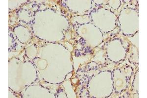 Immunohistochemistry of paraffin-embedded human thyroid tissue using ABIN7161614 at dilution of 1:100 (NINJ2 anticorps  (AA 17-81))