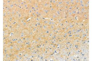 ABIN6261368 and ABIN6273232 at 1/100 staining Rat brain tissue by IHC-P. (DBN1 anticorps  (Internal Region))
