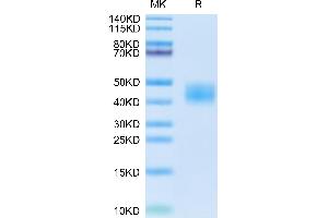 Cynomolgus carbonic anhydrase XII on Tris-Bis PAGE under reduced condition.