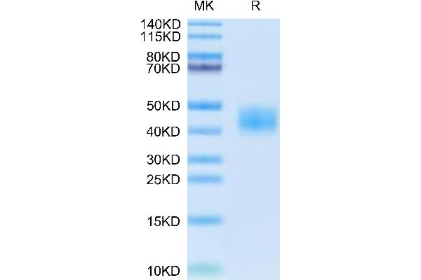 CA12 Protein (AA 25-299) (His tag)