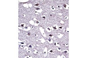 OPRM1 Antibody (Center) ((ABIN653074 and ABIN2842674))immunohistochemistry analysis in formalin fixed and paraffin embedded human brain tissue followed by peroxidase conjugation of the secondary antibody and DAB staining.