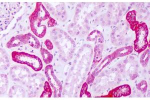 Image no. 1 for anti-Phenylalanyl-tRNA Synthetase, alpha Subunit (FARSA) (AA 276-325) antibody (ABIN6749793)