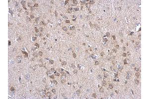 IHC-P Image INPP5F antibody detects INPP5F protein at cytosol on mouse fore brain by immunohistochemical analysis. (INPP5F anticorps)