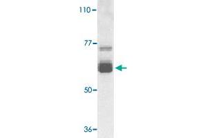 Western blot analysis of IL22RA1 expression in human HepG2 cell lysate with IL22RA1 polyclonal antibody  at 1 ug /mL . (IL22 Receptor alpha 1 anticorps  (N-Term))