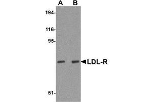 Western Blotting (WB) image for anti-Low Density Lipoprotein Receptor (LDLR) (Middle Region) antibody (ABIN1030978) (LDLR anticorps  (Middle Region))