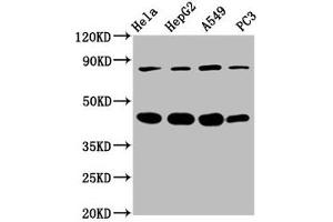 Western Blot Positive WB detected in: Hela whole cell lysate, HepG2 whole cell lysate, A549 whole cell lysate, PC-3 whole cell lysate All lanes: PIK3R6 antibody at 3. (PIK3R6 anticorps  (Regulatory Subunit 6))