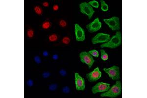 ABIN6260349 and ABIN6269173 staining Hela cells by IF/ICC. (CEBPB anticorps  (Internal Region))