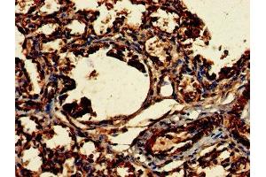 Immunohistochemistry of paraffin-embedded human lung tissue using ABIN7147821 at dilution of 1:100 (Clarin 2 anticorps  (AA 31-100))