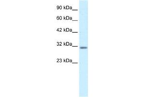 WB Suggested Anti-BARX1 Antibody Titration:  0. (BARX1 anticorps  (Middle Region))
