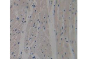 Used in DAB staining on fromalin fixed paraffin- embedded Kidney tissue