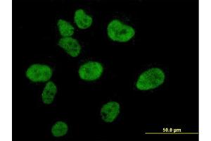 Immunofluorescence of monoclonal antibody to CREBBP on HeLa cell.