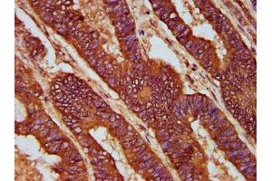 anti-CD2-Associated Protein (Cd2ap) (AA 333-426) antibody