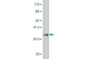 Western Blot detection against Immunogen (34.