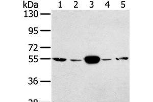 Western Blot analysis of Hela and K562 cell, Human fetal muscle tissue, A375 and hepg2 cell using TRIM35 Polyclonal Antibody at dilution of 1:400 (TRIM35 anticorps)