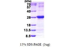 SDS-PAGE (SDS) image for Nudix (Nucleoside Diphosphate Linked Moiety X)-Type Motif 4 (NUDT4) (AA 1-180) protein (His tag) (ABIN5852976)