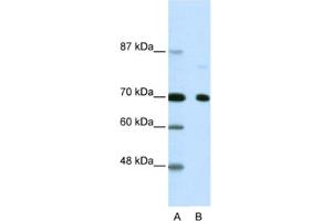 Western Blotting (WB) image for anti-Nuclear Receptor Co-Repressor 2 (NCOR2) antibody (ABIN2460476) (NCOR2 anticorps)