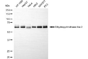 Western blotting analysis using dihydropyrimidinase like 2 antibody (ABIN7798337).