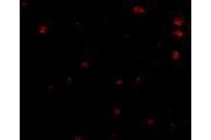 Immunofluorescence of human brain tissue using AP30335PU-N FEZ2 antibody at 5 μg/ml. (FEZ2 anticorps  (Center))