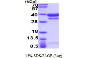 Cathepsin B (CTSB) (AA 18-339) protein (His tag)
