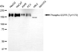 Western blotting analysis using phospho-EGFR (Tyr) antibody (ABIN7798466).