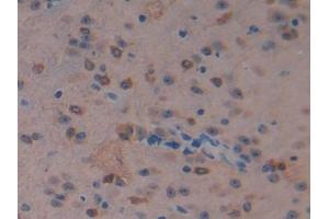 DAB staining on IHC-P; Samples: Mouse Cerebrum Tissue (MST1 anticorps  (AA 469-704))